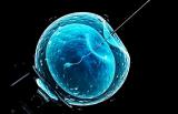 卵细胞库答疑：做供卵试管有年龄限制吗？