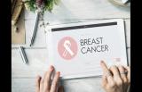 哪些类型的乳腺癌容易复发？有这几个特征的人要警惕
