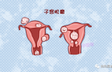 中国有三分之一女性，都患过这种疾病，对胚胎发育有影响