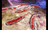 霍乱弧菌——人类榨汁机，真正让人上吐下泻的病毒，死亡率最高6成