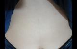 孕妇肚子上的黑线越来越明显，和这个原因有关，其他没有科学依据